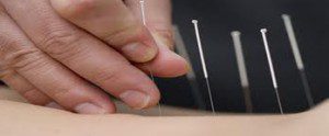 5 Questions Drew Nesbitt Toronto Acupuncture 300x124 Research: Disorder Specific Acupuncture and Menopause Relief