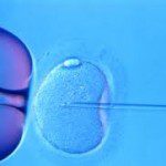IVF picture 150x150 Acupuncture and IVF: Pre and Post Treatments