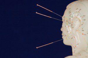 acupuncture pic 21 300x199 How Does Acupuncture Really Work?