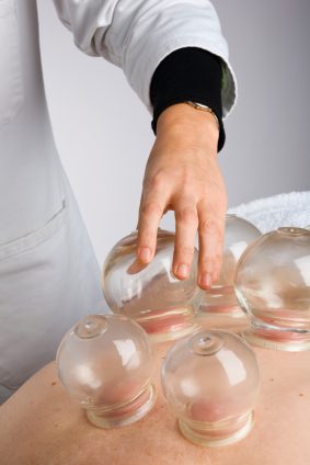 Cupping photo Services