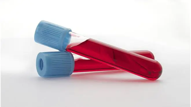 AMH blood test AMH - Testing Ovarian Reserve