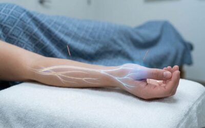 Acupuncture for Nervous System Regulation